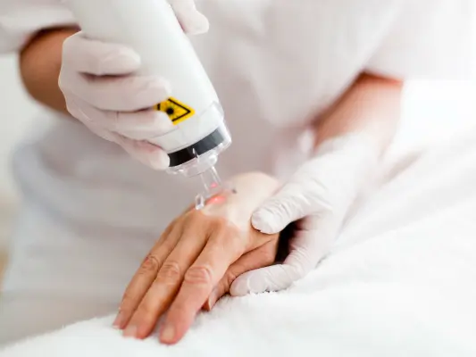 Laserbehandlung zur Handverjüngung in einer Praxis für ästhetische Medizin