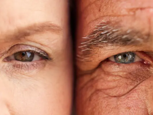Augenringe und feine Fältchen unter den Augen