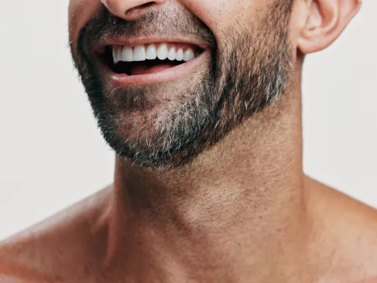LaseMD, CO2-Laser oder RF-Microneedling? Welche Hautbehandlung eignet sich wann?